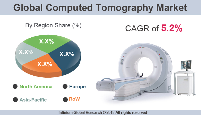 Global Computed Tomography Market