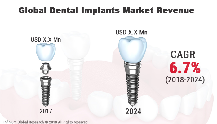 Dental Implants Market